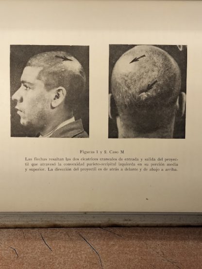 Investigaciones sobre la nueva Dinámica Cerebral. La actividad cerebral en función de las condiciones dinámicas de la excitabilidad nerviosa. 2 Tomi. Premio del Consejo de Investigaciones Científicas en 1941.